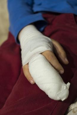Более тысячи псковичей получили травмы на улицах города с начала года